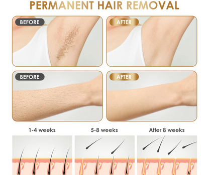 IPL Hair Removal Device for Women – Painless, Silky Skin at Home